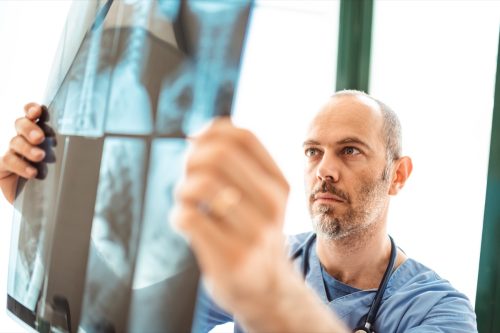 doctor checking the xray of pneumonia at hospital