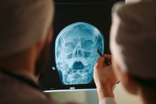 Doctors watching x-ray of patient.