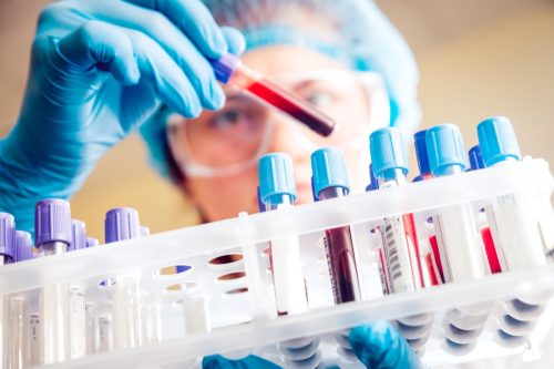 Scientist holding tray of blood vials