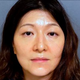 California Dermatologist Arrested For “Poisoning Her Husband” After He Set Up Camera to Prove It