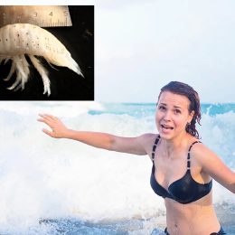 Flesh-Eating, Blood-Drawing, Piranha-Like Bugs Are Terrorizing People on California Beaches