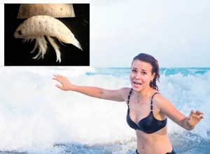 Flesh-Eating, Blood-Drawing, Piranha-Like Bugs Are Terrorizing People on California Beaches