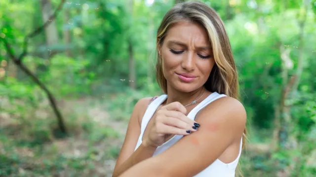 Irritated young female scratching her itching arm from a mosquito bite at the park during summertime.