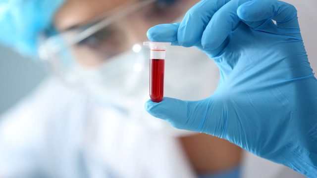 Woman,Holding,Test,Tube,With,Blood,Sample,,Closeup