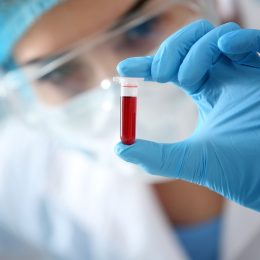 New Blood Test That Could Revolutionize Alzheimer’s Treatment: 7 Things to Know