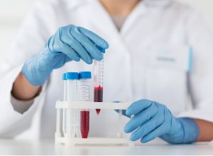 Laboratory-Grown Blood Has Been Put Into People in a First Clinical Trial