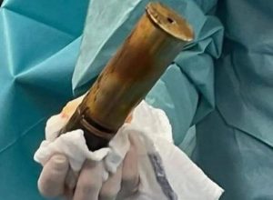 Hospital Evacuated After 88-Year-Old-Man Has WWI Shell Removed From Inside His Body