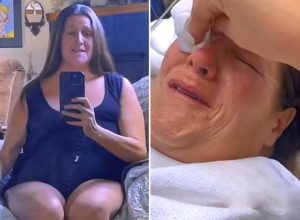 Heart-Melting Moment Woman Who Lost 350 Pounds Bursts Into Tears of Joy After Surgically Removing 47 Pounds of Excess Skin. “I Deserve to Be Happy.”