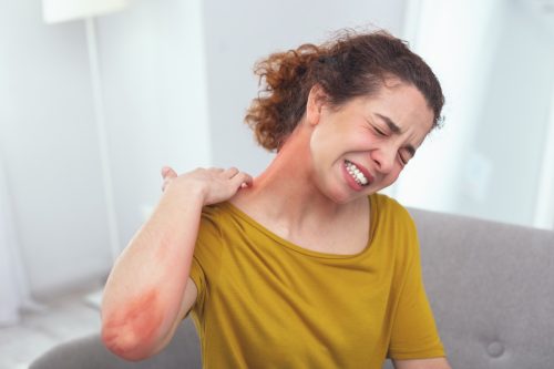 Spreading rash. Young lady in pain looking awfully sick suffering from a spreading skin rash affecting her neck