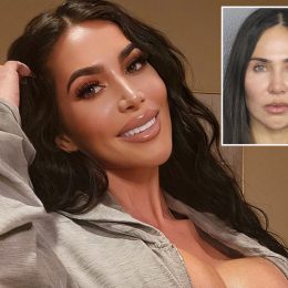 Kim Kardashian Look-Alike Dies After Surgery