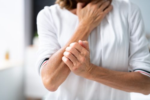 Woman Scratching Itching Body Skin With Allergy