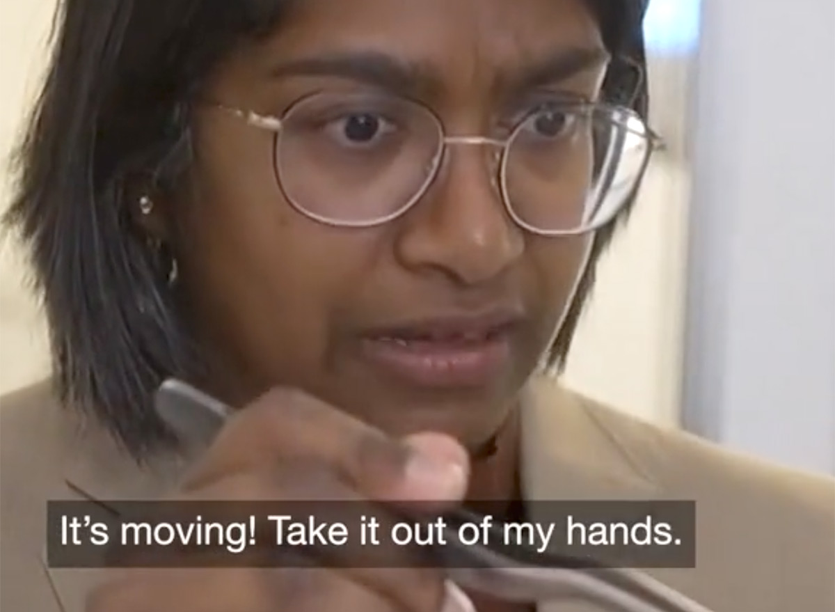 3-Inch Live Worm Found Woman’s Brain