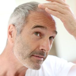 7 Things You Should Never Do if You're Going Bald