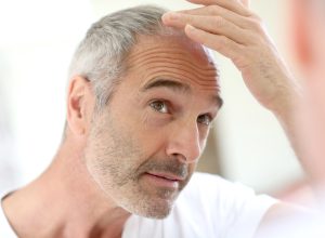 7 Things You Should Never Do if You're Going Bald