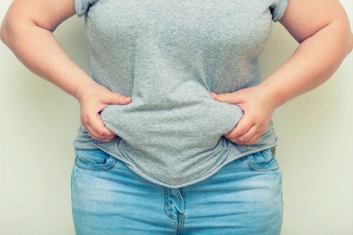 Obese Woman Holding His Belly Fat With Both Hands