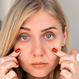Ophthalmology, vision problems. Portrait of 30 year old blue eyed woman, pulling back skin under her eyes, looks at camera with frustrated look. Problems of aging and appearance. Optometrist, surgery