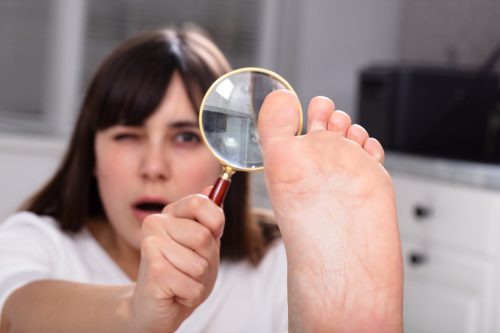 Young Woman Looking At Her Toe Nails With Magnifying Glass.