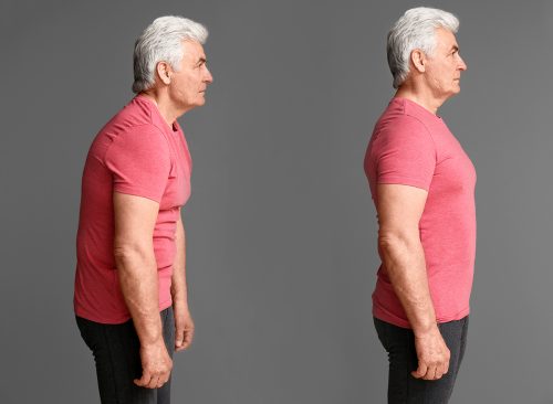 Mature man with poor and good posture on grey background