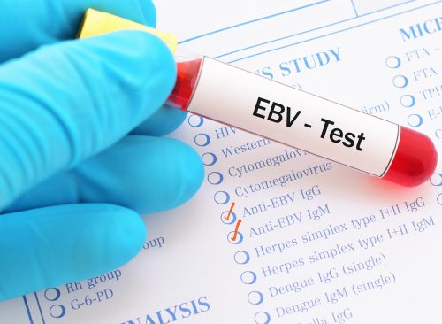 Blood sample with requisition form for Epstein-Barr virus (EBV) test